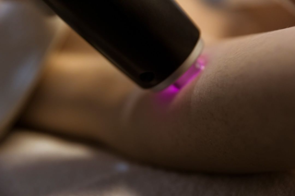 Depilación definitiva laser